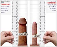 Me v 4everanedger Erect