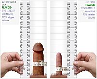 Me v 4everanedger Flaccid