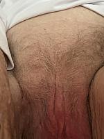 photo of labia