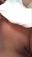 photo of labia