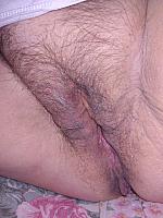 photo of labia