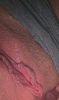 photo of labia