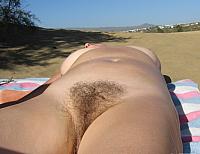 photo of vulva
