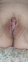 photo of labia