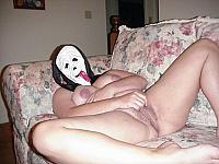 photo of lower lips